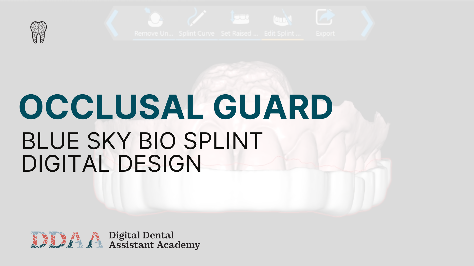 BlueSkyBio Occlusal Guard Design
