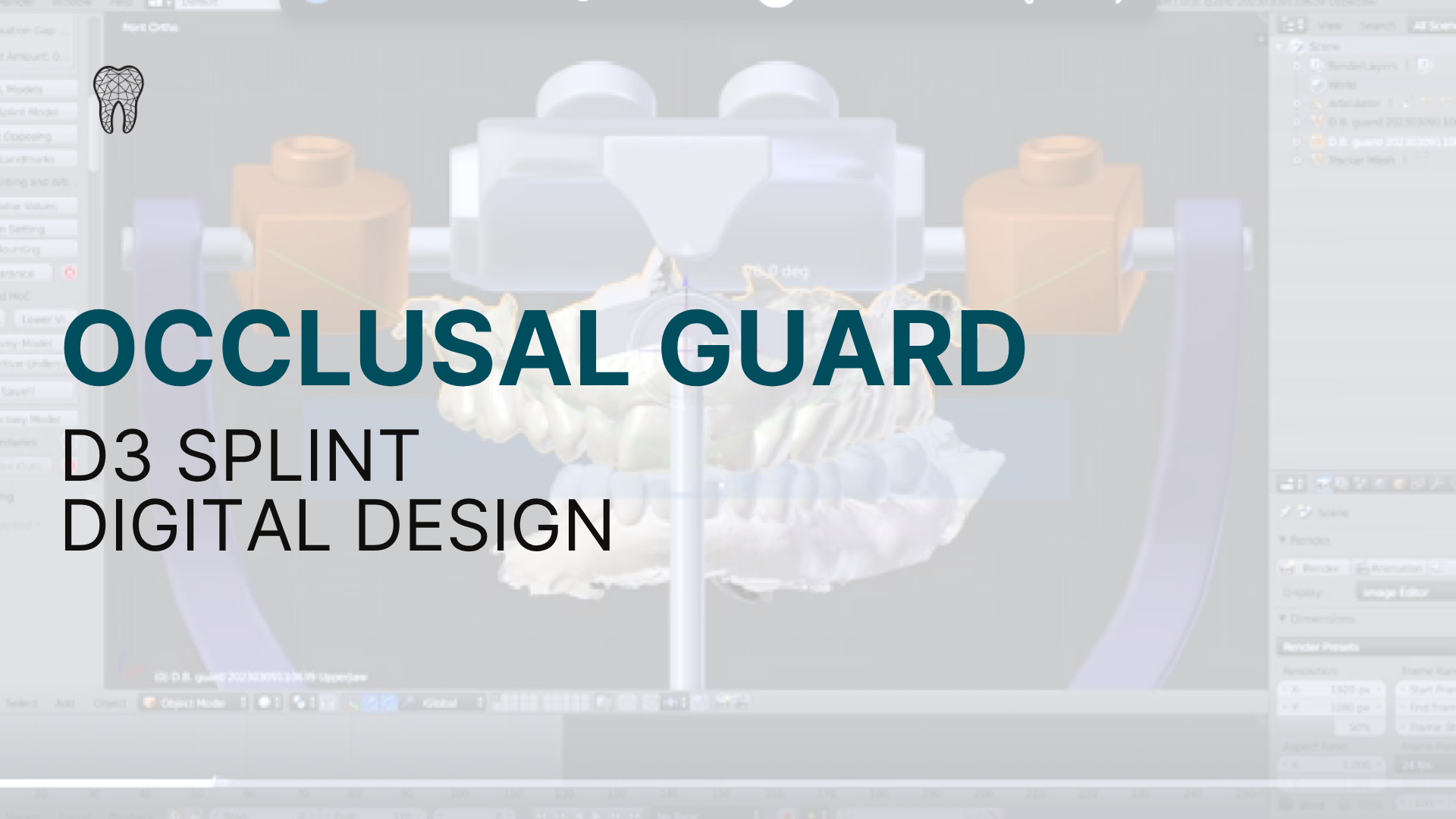 Occlusal Guard D3 Splint Digital Design