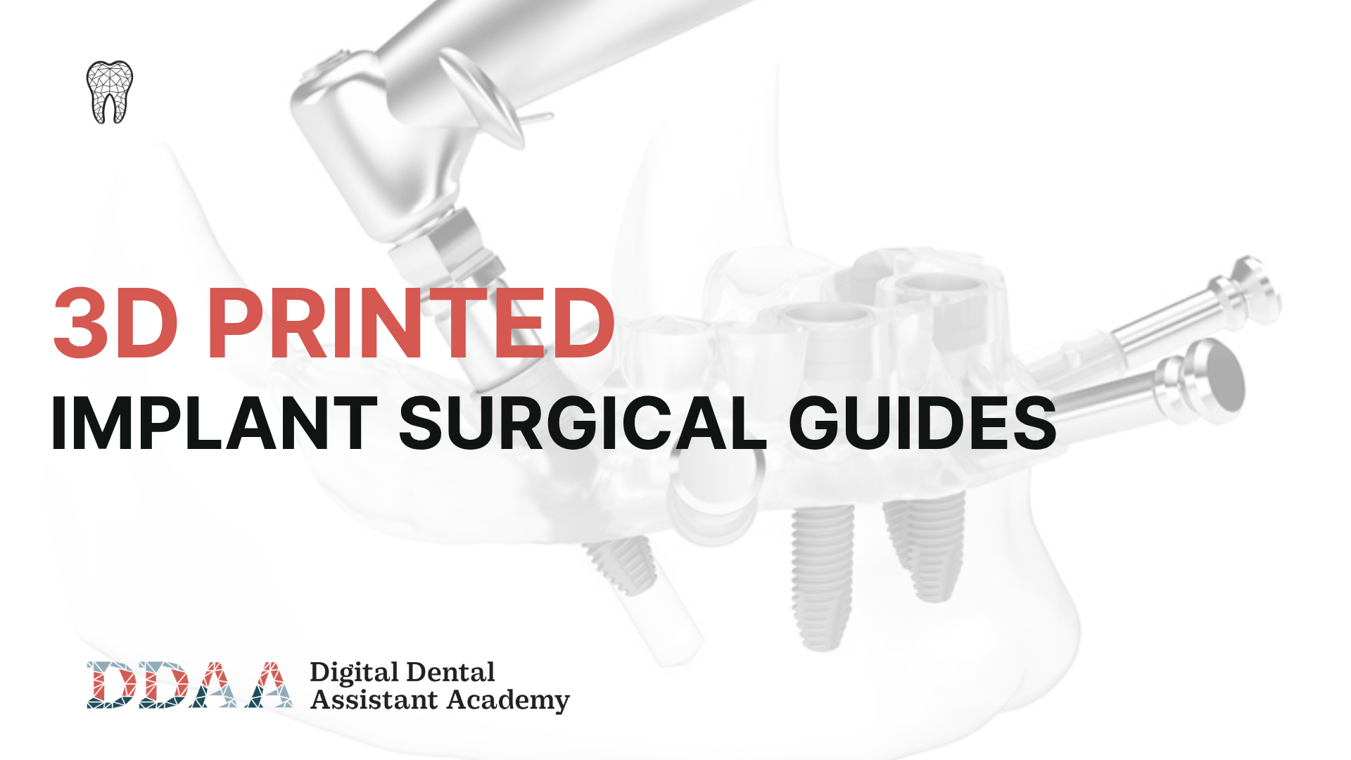 3D Printed Implant Surgical Guides